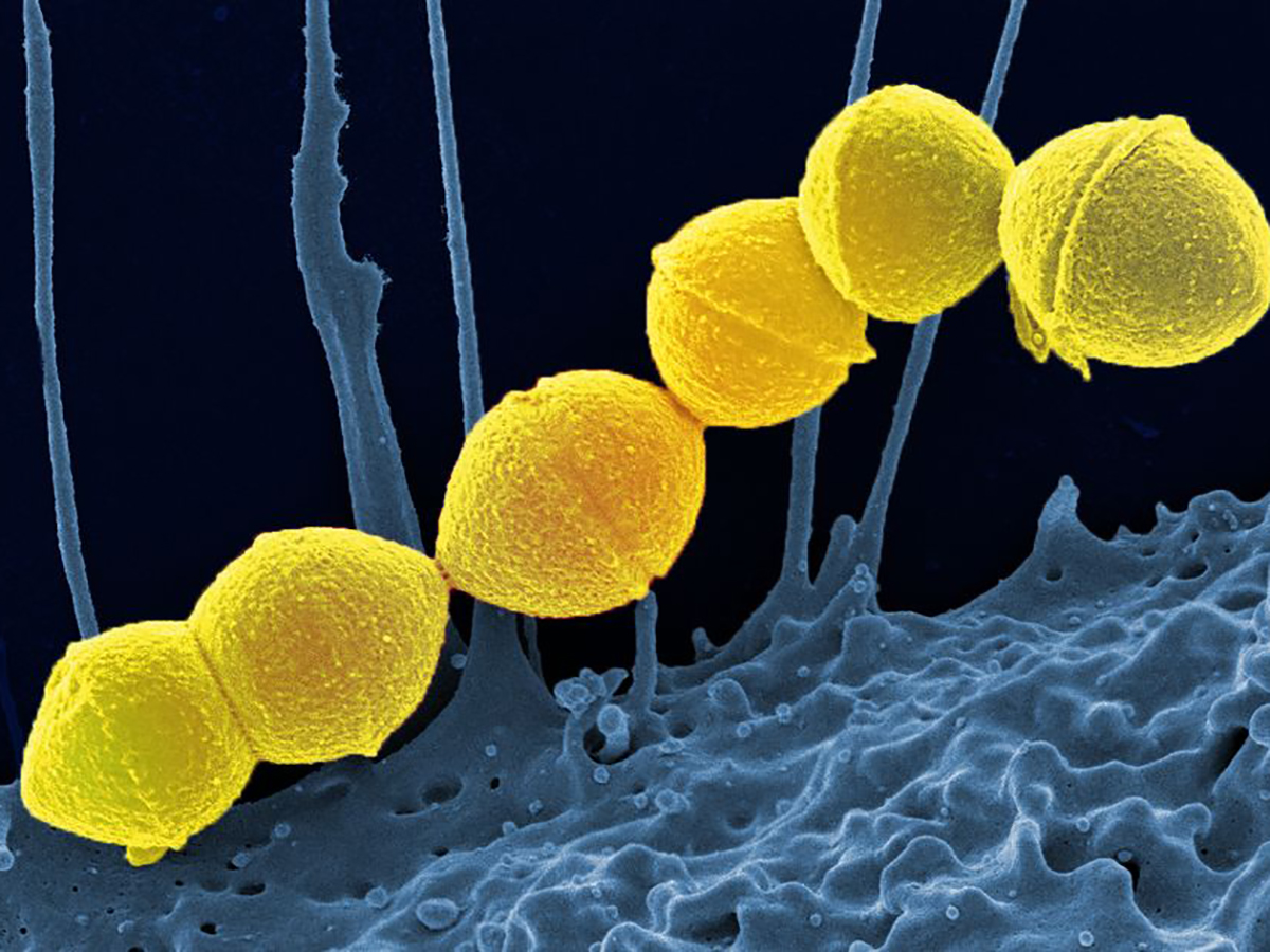 Плотоядная бактерия, убивающая человека за два дня, вызвала панику в Японию