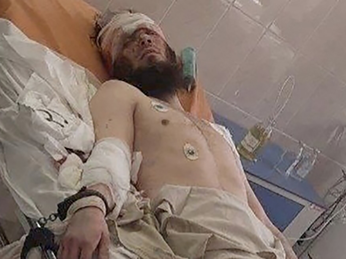 Выживший после захвата заложников в СИЗО террорист вышел из комы и был допрошен
